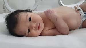 La bebé recién nacida que fue rescatada entre los escombros del terremoto en Turquía y Siria. 